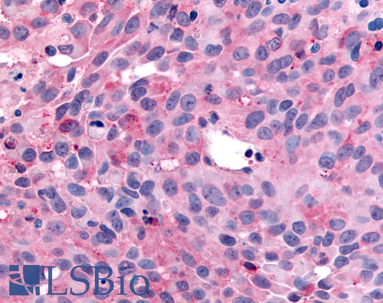 PathPlus™ WNK1 Antibody (C-Terminus)