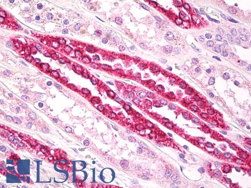 IHC-plus™ Beta Tubulin Antibody (aa417-435)