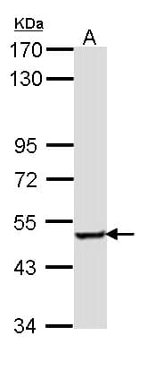 IHC-plus™ Polyclonal Rabbit anti-Human SESN3 Antibody (aa21-296, IHC, WB)