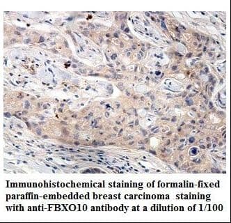 FBXO10 Antibody (aa11-179)