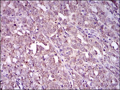 ITGA2B / CD41 Antibody (aa45-149, clone 2E10C9)