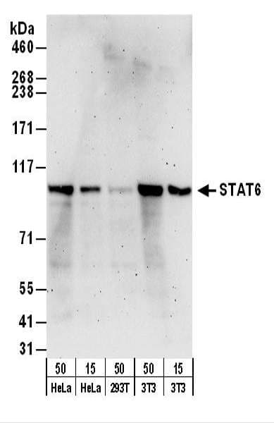 Polyclonal Rabbit anti-Human STAT6 Antibody (aa600-650, IHC, WB)
