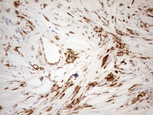 GRN / Granulin Antibody (aa327-593, clone OTI3H6, Carrier-free)