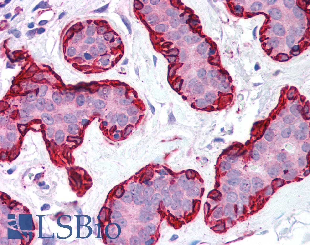 PathPlus™ Polyclonal Rabbit anti-Human ACTA2 / Smooth Muscle Actin Antibody (N-Terminus, IHC)