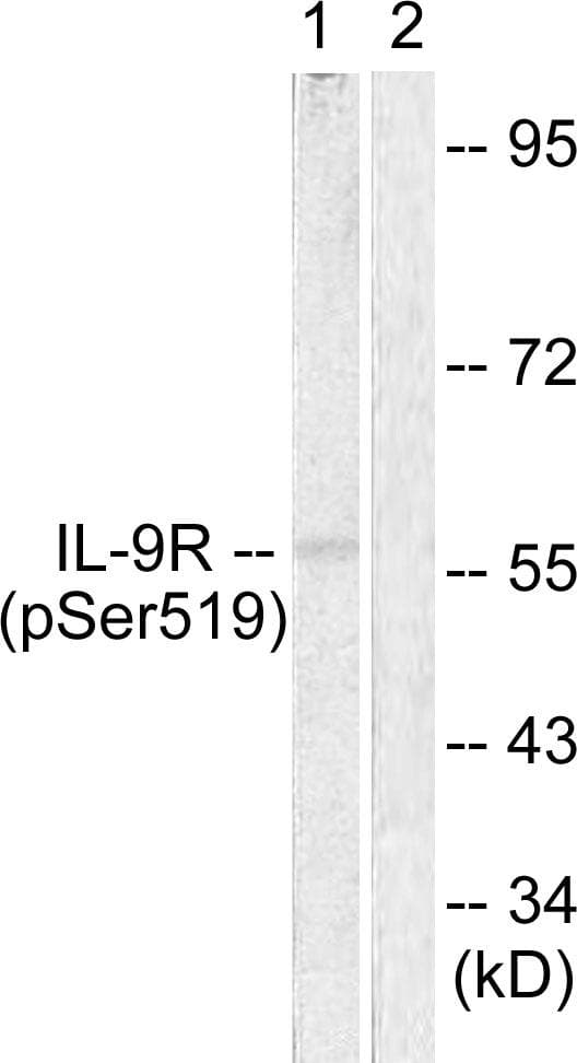 IL9R / CD129 Antibody (phospho-Ser519)