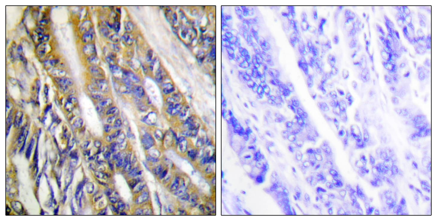 DGKeta / DGKH Antibody (aa771-820)