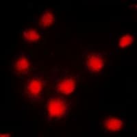 Polyclonal Rabbit anti-Human BRCA1 Antibody (C-Terminus, IHC, IF, WB)