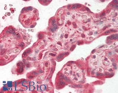 IHC-plus™ MEK1 + MEK2 Antibody