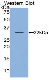 ANPEP / CD13 Antibody (aa720-961)