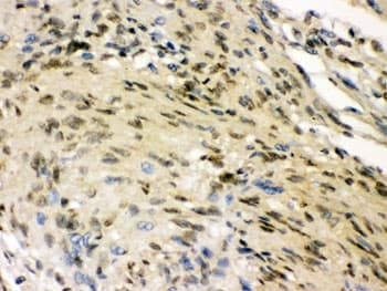 ELAVL4 / HuD Antibody