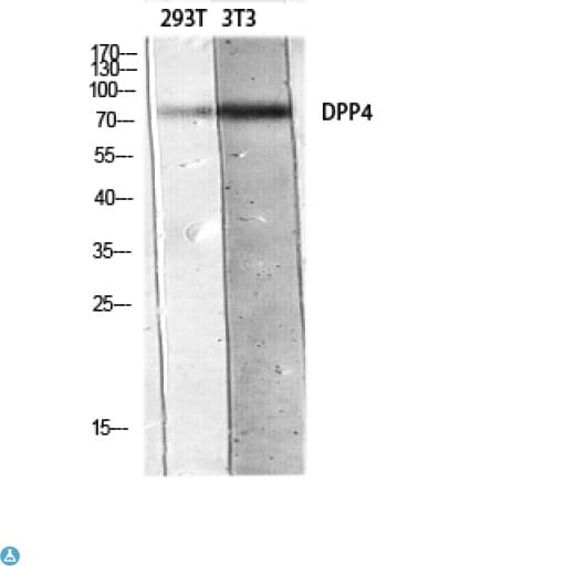 DPP4 / CD26 Antibody