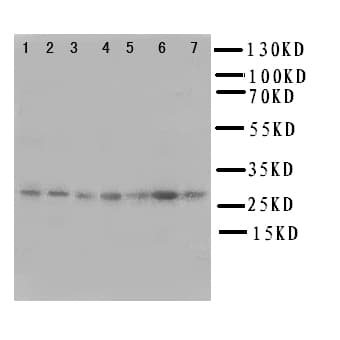 Polyclonal Rabbit anti-Human CACYBP Antibody (aa160-175, IHC, WB)