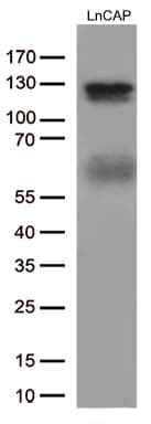 Monoclonal Mouse anti-Human AR / Androgen Receptor Antibody (clone OTI2H2, aa420-659, WB)