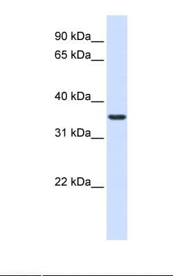 TMX2 / TXNDC14 Antibody (aa110-159)