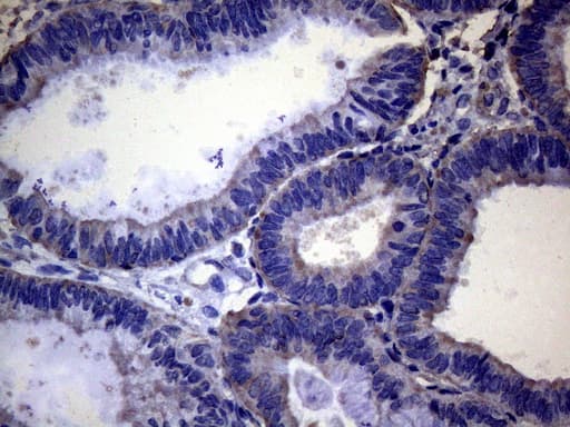 PAPSS2 Antibody (aa1-247, clone OTI6H10)