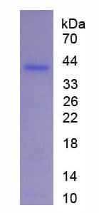 Human GFAP Protein (Recombinant His-S)