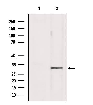 Polyclonal Rabbit anti-Human PDCD1 / CD279 / PD-1 Antibody (IHC, WB)