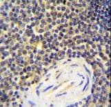 Polyclonal Rabbit anti-Human CENTB1 / ACAP1 Antibody (aa96-125, IHC, WB)