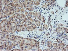 MAP2K1 / MKK1 / MEK1 Antibody (clone OTI6C6)