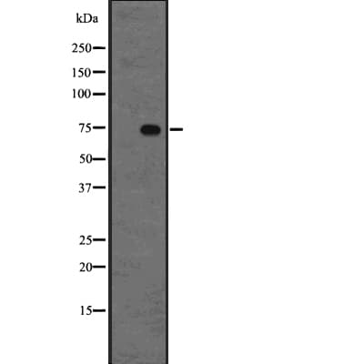 FUBP1 Antibody