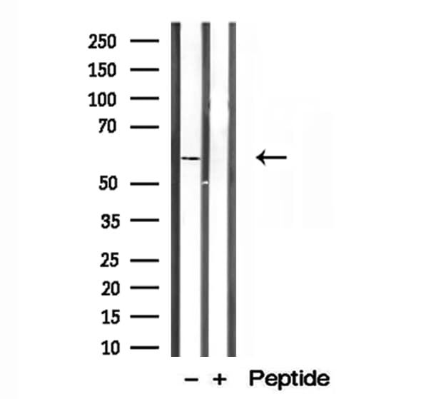 Polyclonal Rabbit anti-Human PPAT Antibody (IHC, WB)