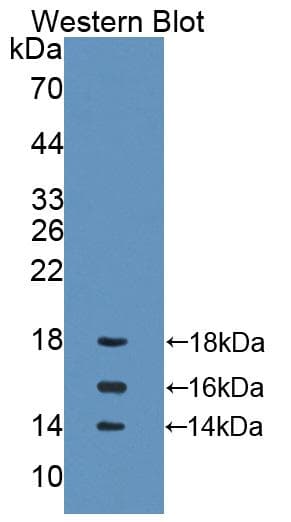 IL15 Antibody (aa49-162)