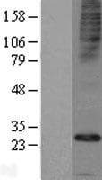 FAM26E Protein (Over-Expression Lysate Myc-DDK (Flag))