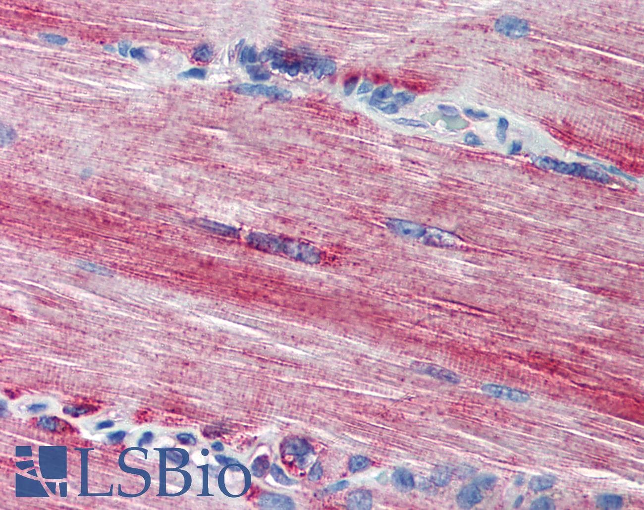 IHC-plus™ ACSL3 Antibody (N-Terminus)