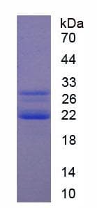Human CIRP / CIRBP Protein (Recombinant His, N-Terminal)