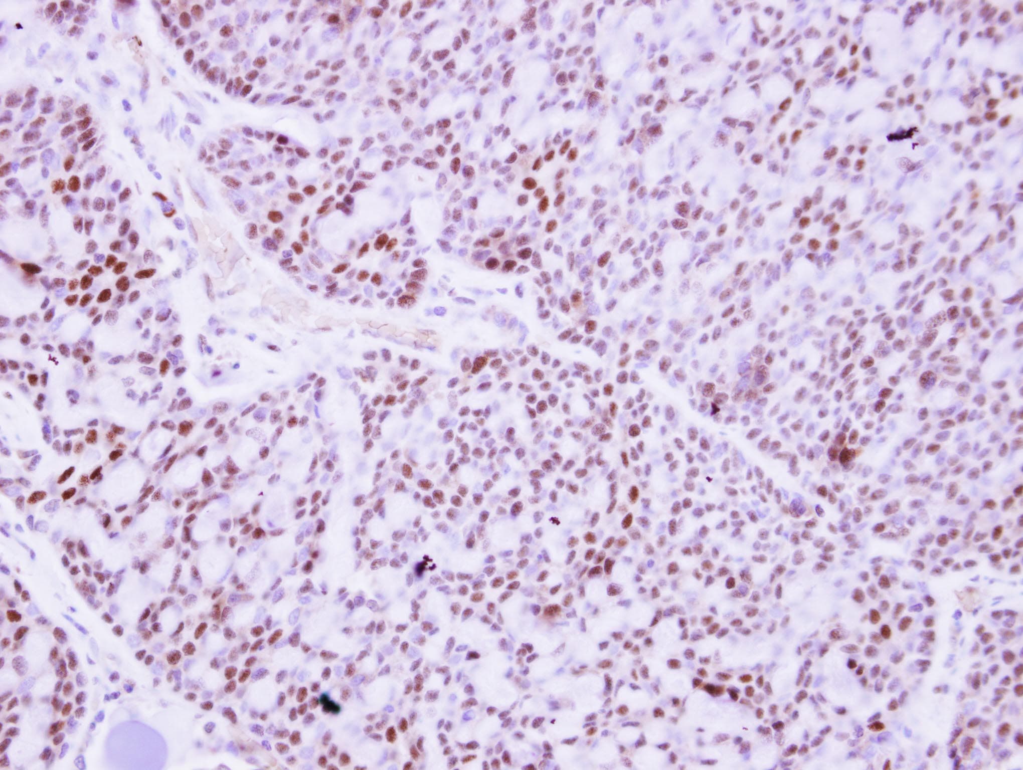 Polyclonal Rabbit anti-Human PTTG2 Antibody (IHC, WB)