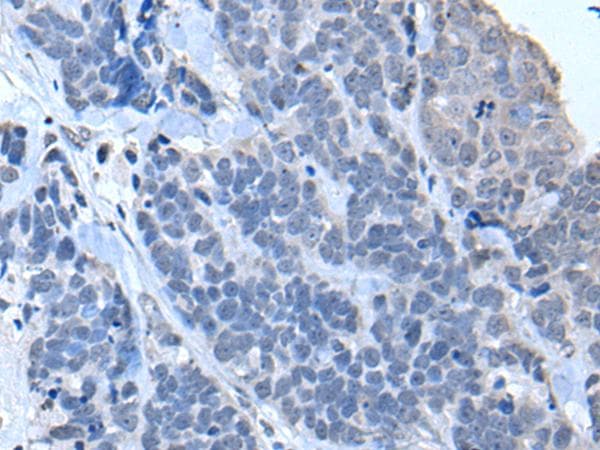 Polyclonal Rabbit anti-Human TIA-1 Antibody (IHC, WB)