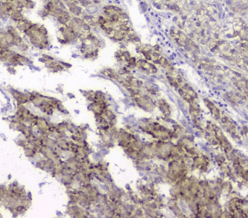 Polyclonal Rabbit anti-Human TIMM17A / TIM17 Antibody (IHC, WB)