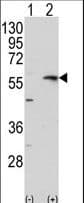 Polyclonal Rabbit anti-Human MMP13 Antibody (aa295-324, IHC, WB)