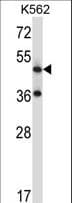 TACR3 / NK3R Antibody (aa406-435)