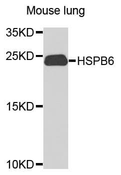 HSPB6 / HSP20 Antibody