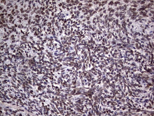 Monoclonal Mouse anti-Human TLK2 Antibody (clone OTI2G1, Carrier-free, aa1-296, IHC, WB)