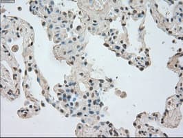 NTRK3 / TRKC Antibody (clone OTI24B3)
