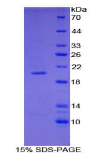 Mouse COL3A1 / Collagen III Protein (Recombinant His)