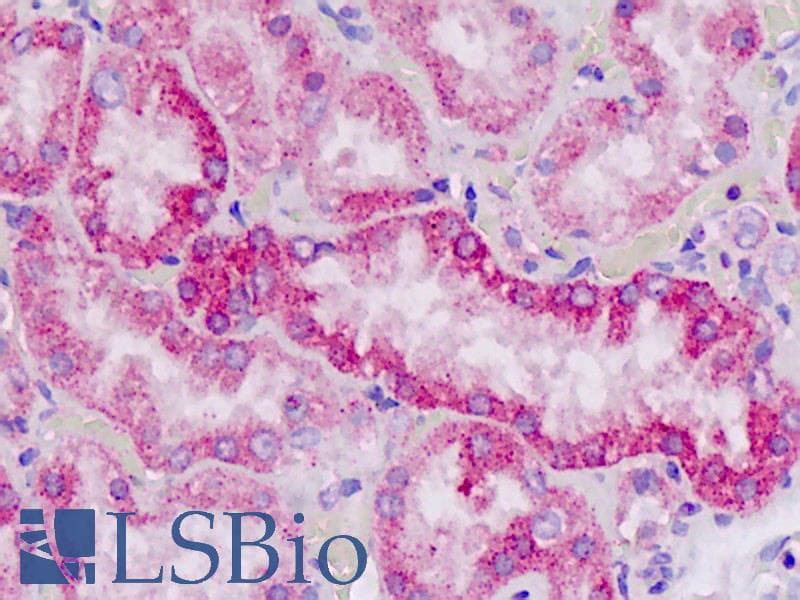 IHC-plus™ Monoclonal Rabbit anti-Human CLPTM1 Antibody (clone EPR8800, N-Terminus, IHC, IF, WB)