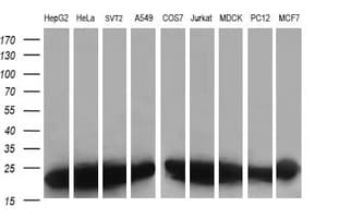 VBP1 Antibody (clone OTI2G2)