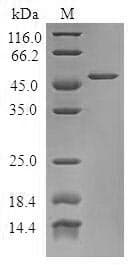 Human TPD52L1 Protein (Recombinant GST, N-terminus)