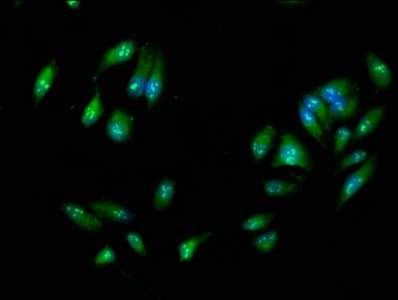 RIPK3 / RIP3 Antibody