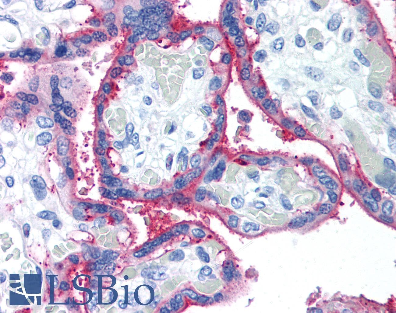 IHC-plus™ Monoclonal Mouse anti-Human CD59 Antibody (clone p282(H19), IHC)