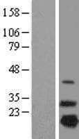 NDUFB7 / B18 Protein (Over-Expression Lysate Myc-DDK (Flag))