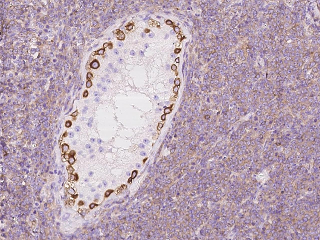 c-CBL Antibody