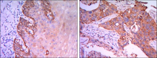 RAB25 Antibody (clone 3F12)
