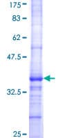 Human FGF11 / FGF-11 Protein (Recombinant GST, N-terminus)
