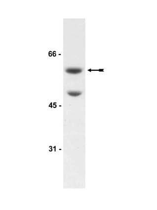 IHC-plus™ AKT3 Antibody (aa119-131)