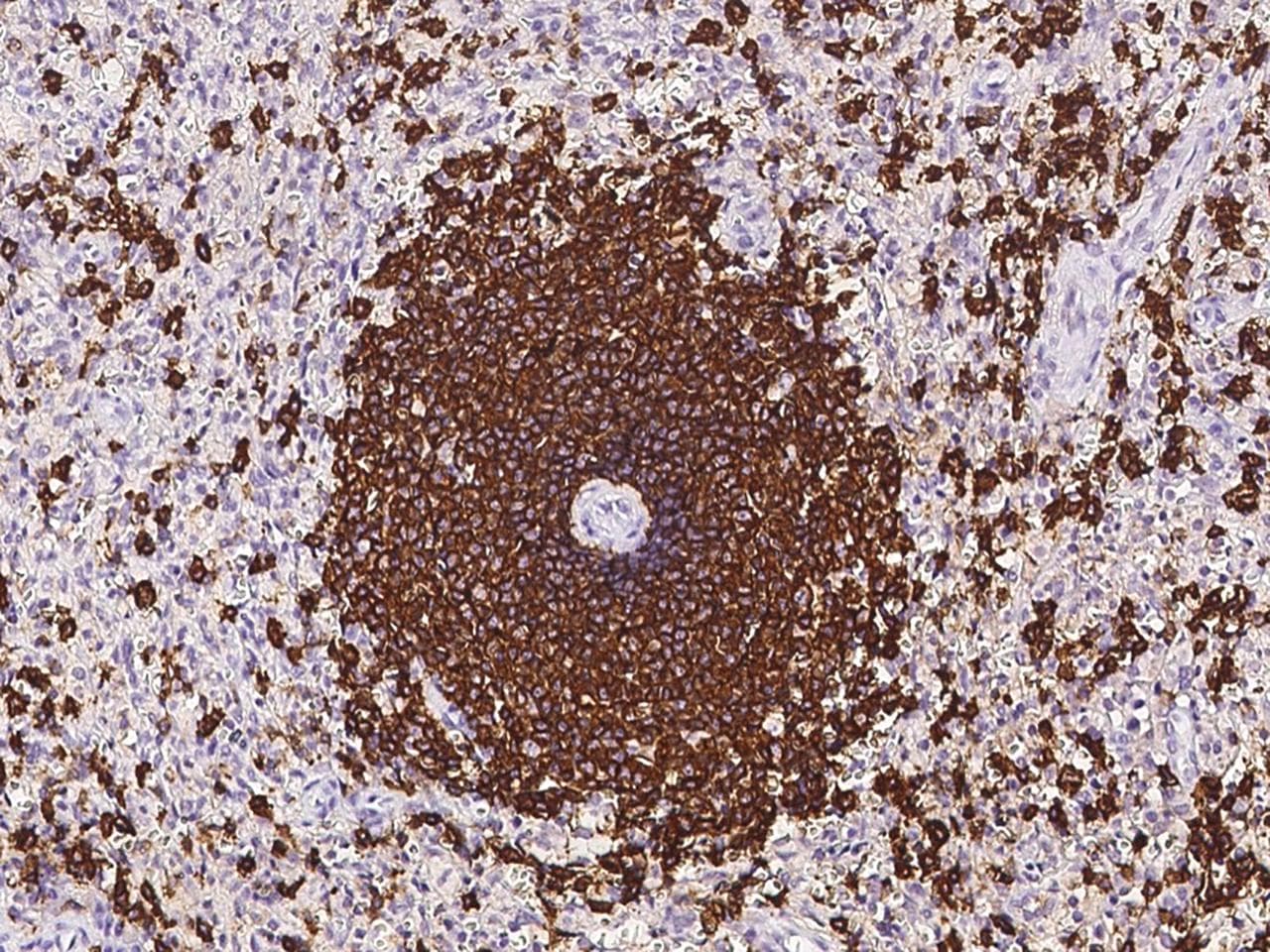 Polyclonal Rabbit anti-Human CD20 Antibody (IHC, IF)