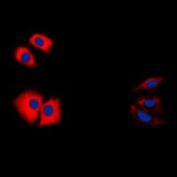 CASP1 / Caspase 1 Antibody (C-Terminus)
